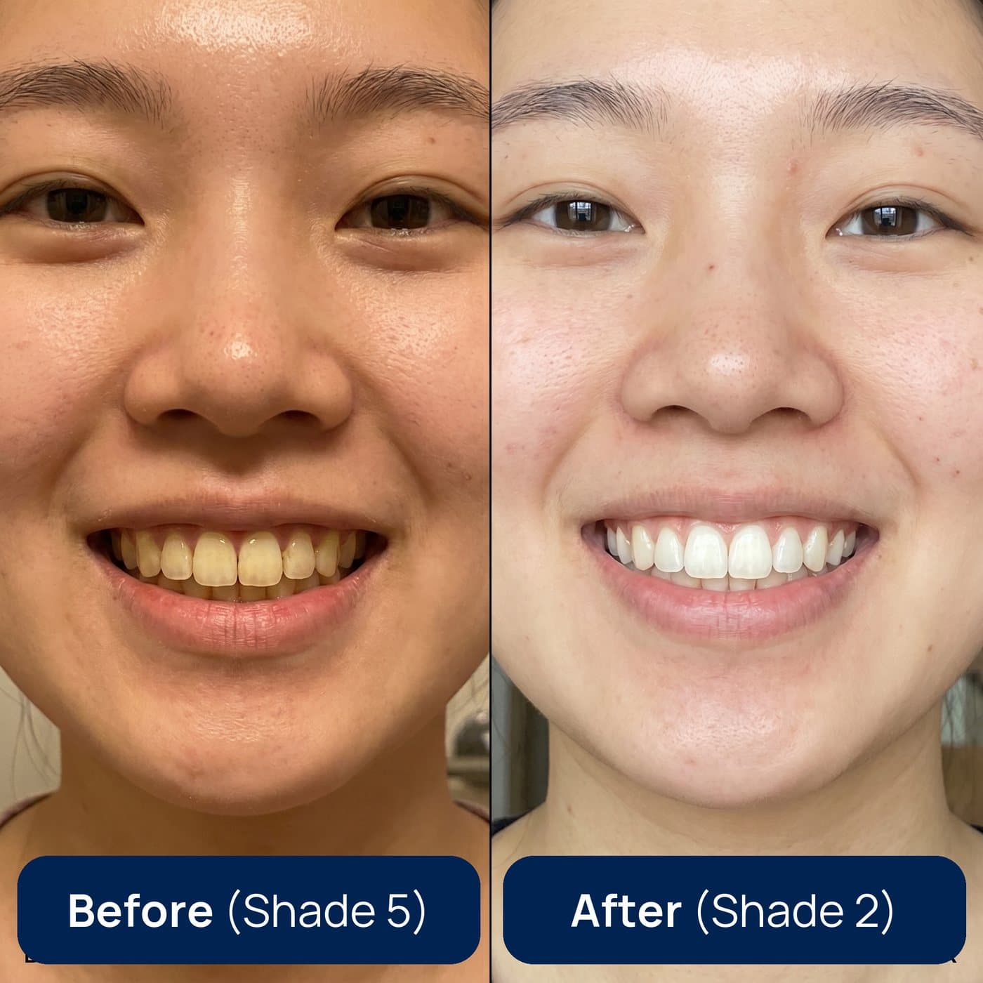 Customer result, Shade 5 → Shade 2